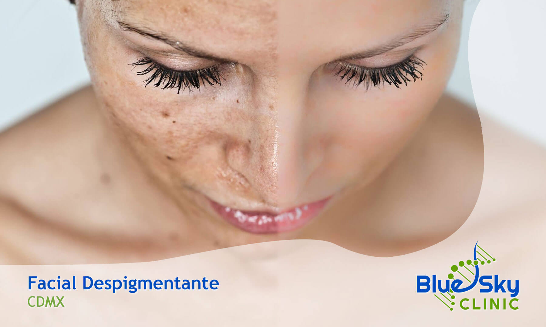 Facial Despigmentante CDMX