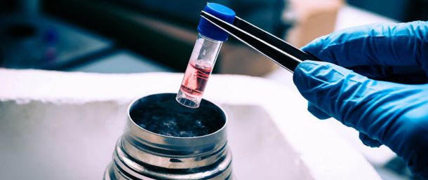 Stem Cells