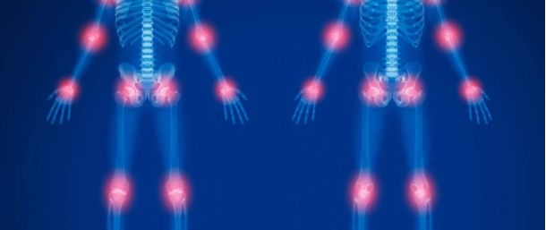 Mesenchymal stem cells as a treatment for the regeneration of degenerative articular diseases.