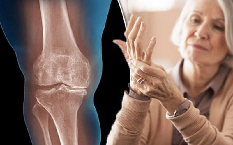 Terapias para Enfermedades Degenerativas